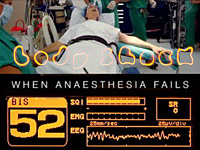 Selhání anestezie